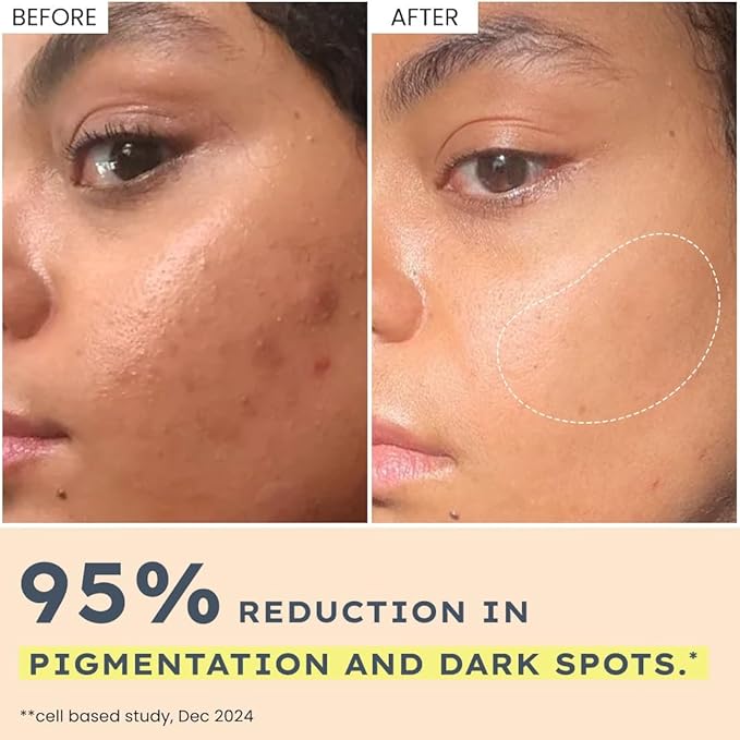 Hyphen 44% Rice Water Brightening Face Serum Pads | 5% Niacinamide & Alpha Arbutin to Reduces Dark Spots & Pigmentation | Toner Pads with Serum for Glowing Glass Skin | All Skin Types - 50N