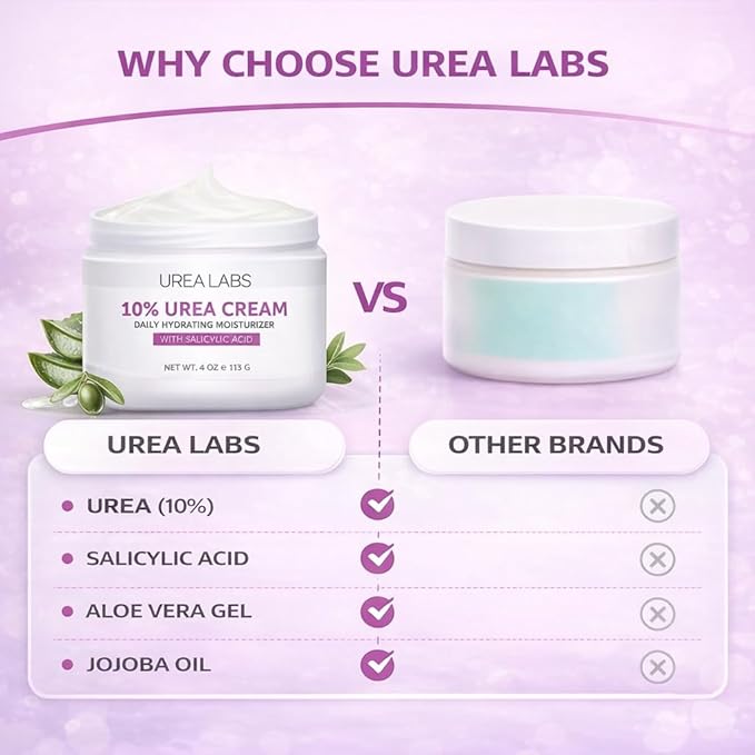 10% Urea Cream with Aloe Vera, Jojoba Oil and Salicylic Acid - 150ml Hydrating Moisturizer for Dry, Chapped Hands, Feet, Face & Body - Repairs, Soothes & Nourishes Rough, Dry Skin - 4 Oz