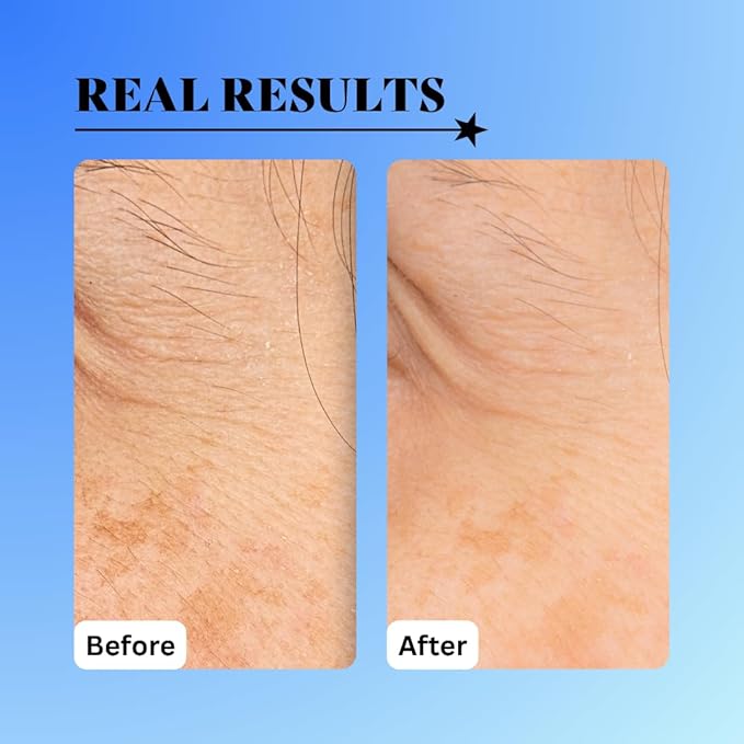 10% Glycolic Exfoliating Treatment Tonic (1oz)