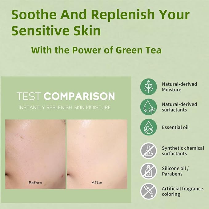 Natural Green Tea Facial Toner & Serum - Anti-Aging, Anti-Wrinkle, Moisturizing & Soothing for Dry Skin - Balances Oil, Reduces Acne, Refines Pores (Travel Size) (2)