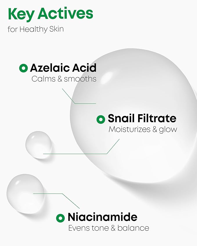 Nineless A-Control Azelaic Acid Toner with AHA & BHA - Pore Refining & Soothing Facial Toner for Acne-Prone Skin - Redness Relief & Dark Spot Corrector, Korean Skincare, 5.07 fl.oz