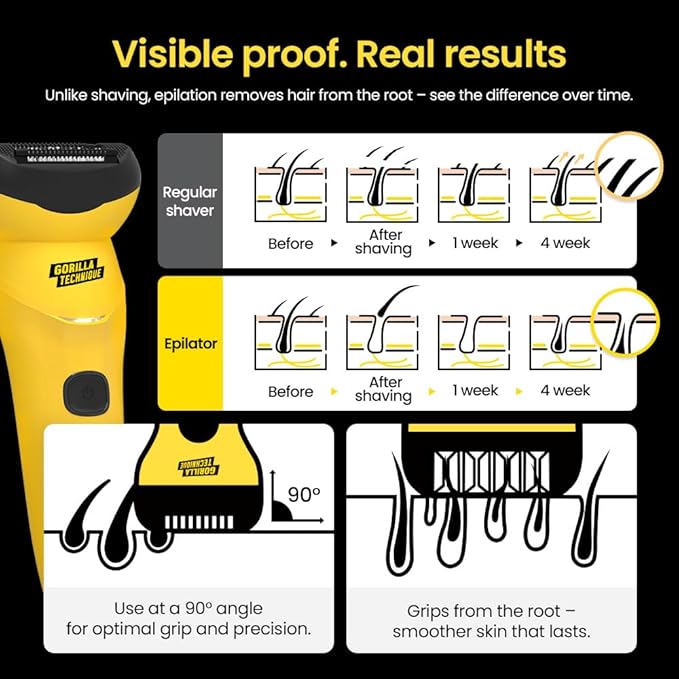 Gorilla Technique Epilator 3000V, Body Hair Removal Device, Pain Relief Roller, Cordless Rechargeable Electric Tweezers for Women & Men, Triple Tweezers, 8000RPM, Korean Skin Care - 3000V