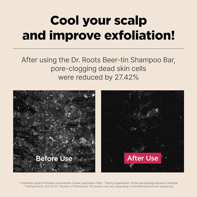 ISOI Dr. Roots Beer-Tin Solid Shampoo Bar, Nourishing & Strengthening Natural Hair Soap Bar Shampoo, with Beer Yeast & Biotin, Plastic-Free Clean Beauty, Korean Hair Care (3.52 oz, 100g)