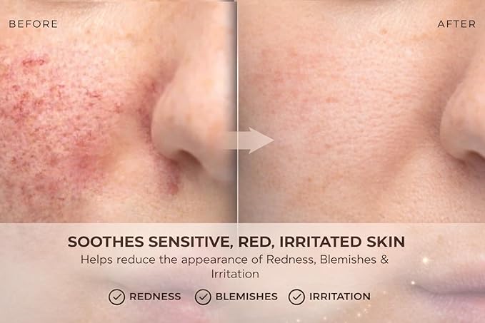 Earth & Elements Hypochlorous Acid Spray 0.015% – pH Balanced HOCl Facial & Body Mist for Redness, Sensitive & Acne-Prone Skin – Soothing Mist – Amber Glass Bottle