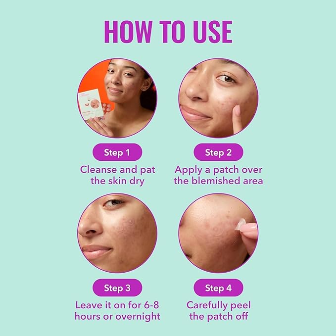 Good Molecules Pimple Patches for Face, 100 Pack – Ultra-Thin Hydrocolloid Acne & Zit Patches, Invisible Under Makeup, Clinically Tested Acne Spot Treatment