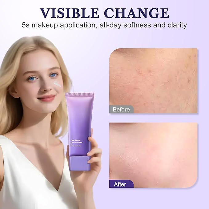2025 New Upgrade All-in-One Niacinamides Cream, Niacinamides Isolation Cream for Face, Waterproof All Over Complexion Perfector, Multi-cream Functions Concealer Smoothly for All Skin Types (1)