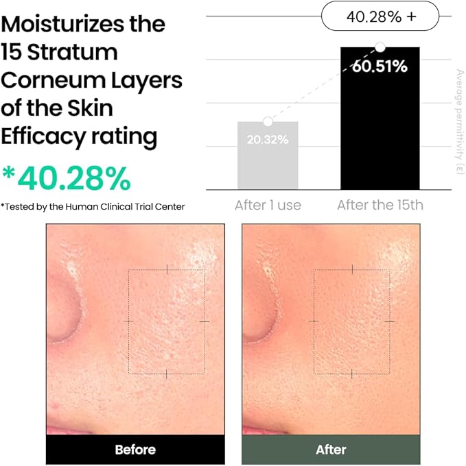 Liposome Waterful Bubble Serum, Hydrating Foaming Toner for Sensitive Skin with Centella Asiatica TECA, Korean Skincare for Trouble Care (5.07 fl. oz, 150ml)