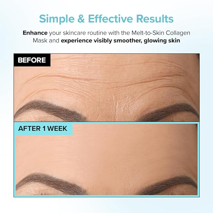 Melt to Skin Collagen Mask, – Wrinkle Patches for Forehead, Eyes & Smile Lines - Frown Lines, Eleven-Lines Repair Patches, Invisible Face Wrinkles Smoothers - Korean Skin Care, 12EA (12)