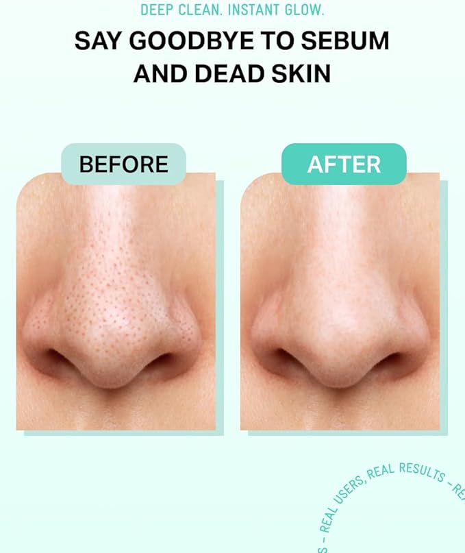 BRING GREEN Tea Tree Cica Sebum Cleaning Gel Set | Korean Blackhead Remover & Pore Minimizer with Pore Cleaner Tool | Sebum Softener for Face, Nose & Chin | Gentle Alternative to Pore Strips & Vacuums