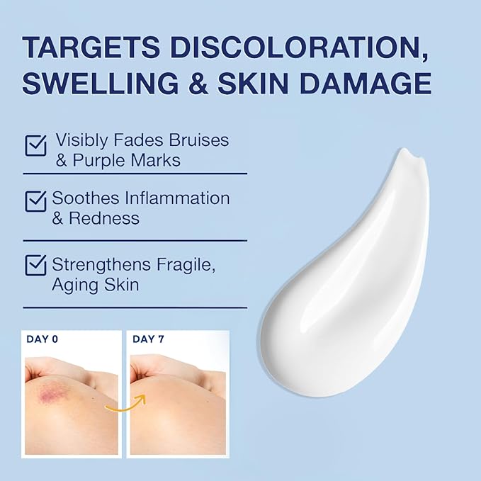 Arnica Bruise Cream Extra Strength – Fast-Acting Arnica Montana with Vitamins K, C & E for Bruising, Swelling, Discoloration & Thin Skin – Hydrating Moisturizer for Face & Body – 4 oz