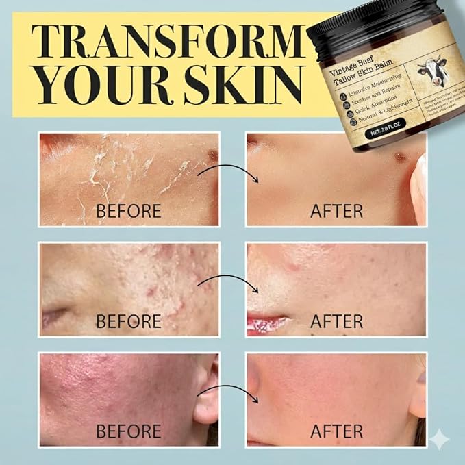 Beef Tallow Honey Balm for Sensitive Skin:100% Organic Grass-Fed Vintage Tallow Moisturizer For Face Cracked Hands Non-Greasy Nourishing Cream With Olive Oil - Eczema Safe All Skin Types 4 oz