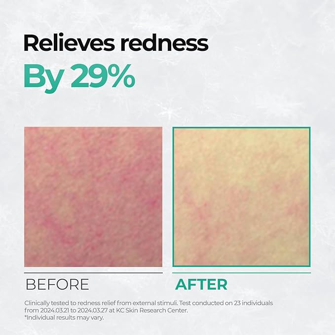 Cell Fusion C Post Alpha CICA Cooling Toner Pad - Redness Relieving & Cooling Korean Toner Pads | Centella Asiatica & Madecassoside | Hydrating, Soothing, Smoothing | 70 Pads / 6.08 fl.oz.