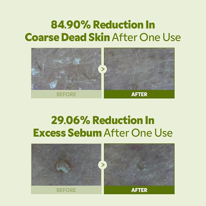 TIRTIR Matcha PDRN Bubble Tea Scrub | Soft Low-pH 6.6 Exfoliator, 5,000ppm Vegan Matcha PDRN, 6 Ceramide Complex, Redness Relief for Sensitive Skin, Korean Skincare, All Skin Types, (100g, 3.52oz)