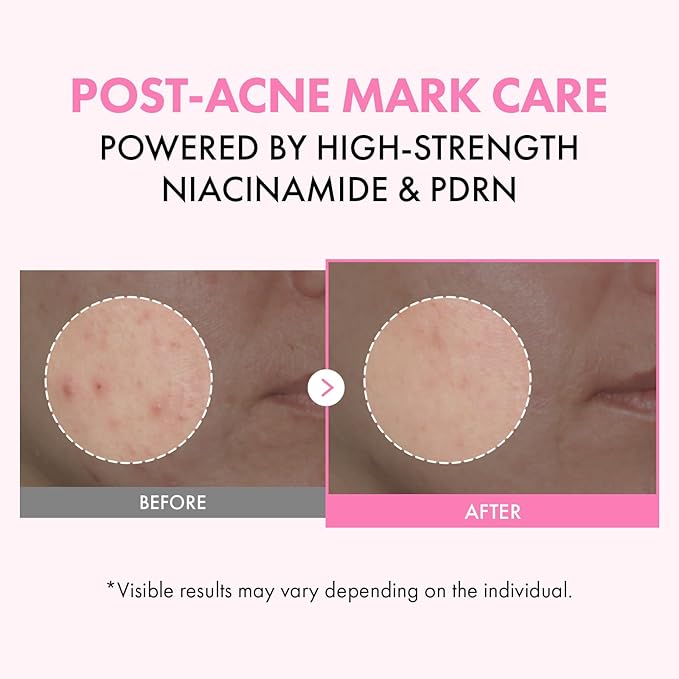 TOSOWOONG Pink PDRN Niacinamide Milky Toner, Niacinamide 5% Dark Spot Care, Salmon DNA PDRN Soothing, 3 Ceramides & 12 Peptides Moisturizing, Glass Glow Skin, Korean Skincare, 150ml / 5.07 fl. oz.