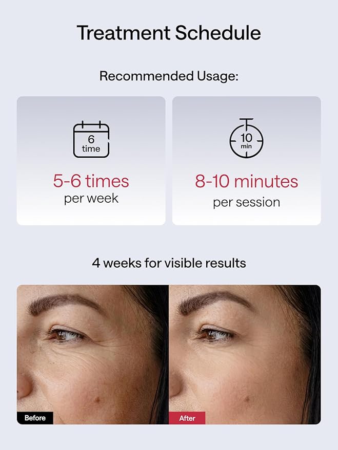 JMOON by Ulike Microcurrent Facial Device, M30U Red Light Therapy for Face, Safe Anti Aging Skin Care, 4 Modes, 5 Energy Levels for Full Face Lift and Ideal for Smile Lines, Eyes, and Forehead (Red)