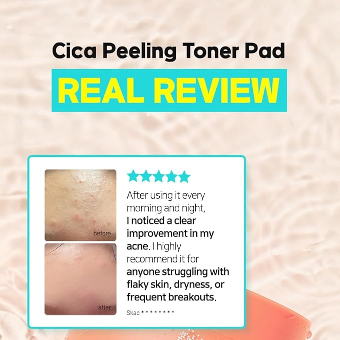 Elishacoy | TETRAFORCE Cica Peeling Toner Pads, Gentle Exfoliating & Calming Toner with Cica, Daily Skin Smoothing & Hydration, Vegan & Dermatologist Tested, 150 mL