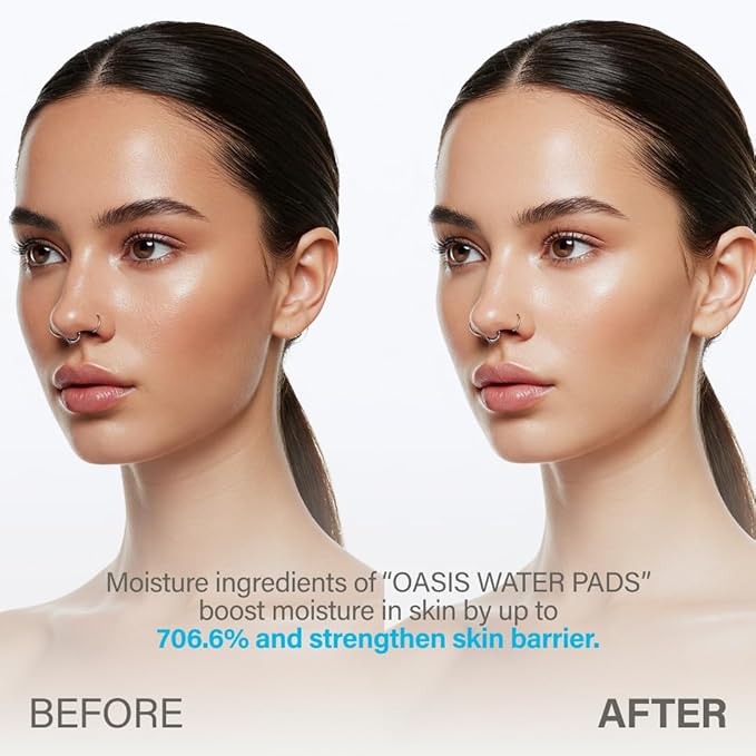 KEYTH Oasis Water PAD (150ML, 5.07 FL.OZ.) / Hydration, Moisturization, Hyal-Barrier, Acetyl Glutamine, 3 Layer Sheet