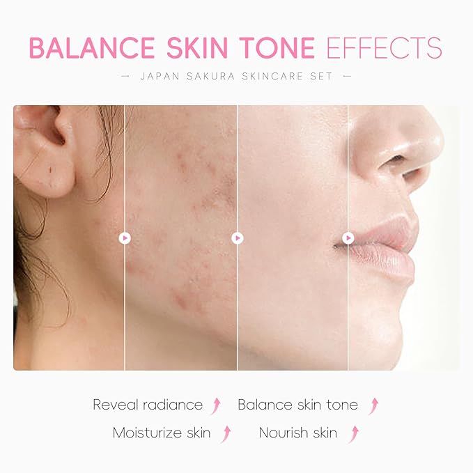 6Pcs Sakura Skincare Kit, The Skin Care Set Includes Facial Cleanser, Toner, Lotion, Essence, Eye Cream And Face Cream, Beauty Skin Care Travel Present Set For Teenage Girls Women