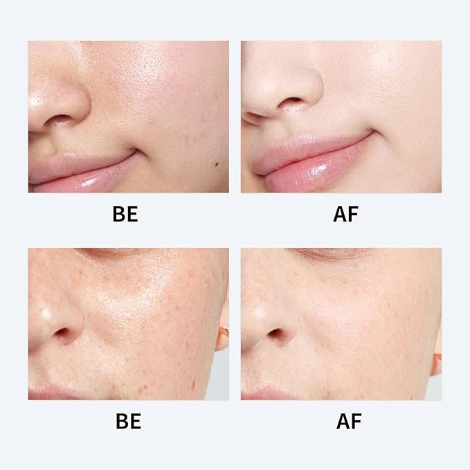 Youthful Formula Ultimate Moisturizing Cream, Korean Gel, Youthful Formula Moisturizing Cream,For All Skin Types 2pcs