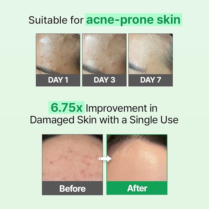 Zipiderm EGF Skin Barrier 4-Step Repair Set – Milky Toner, Hydrating Ampoule, Intensive Cream & Dressing Sheet Mask | Ceramide, Panthenol & Bio-EGF Korean Skincare Routine for Damaged, Dry & Sensitive