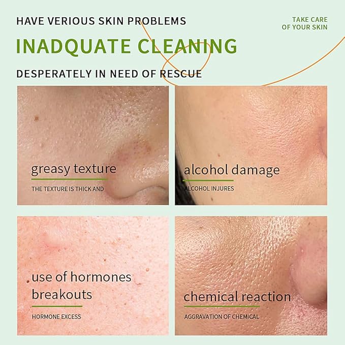 3 PCS Aloe Vera Gel Smoothing After Sun Deeply Hydrating Nourishing Skin Care, for Face Body and Hair - Sunburn, Redness and Itchy Skin Relief 1.41 Fl Oz