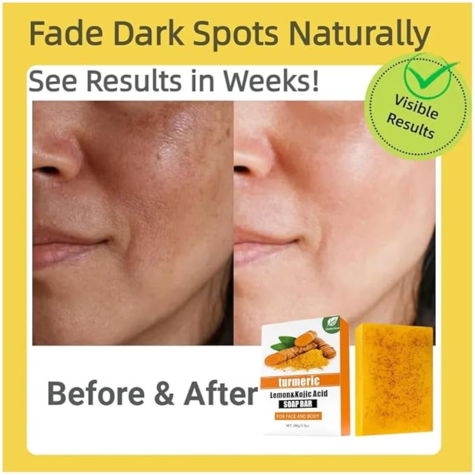2 Pack Turmeric & Lemon Glow Soap Bar - Botanical Duo Power for Dark Spots, Skin Brightening with Kojic Acid, Vitamin C，Retinol- 3x Moisturizing with Amino Acid & Shea Butter - SLS Free