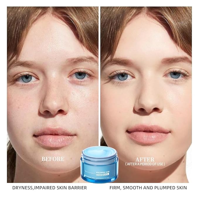 Hydro Boost Hyaluronic Acid Moisturizing Cream, Face Moisturizer For Oil Skin, Hyaluronic Acid Formula Combined With Water,Lightweight and 24 Hours Of Long-lasting Hydration-1.76Oz (Cream)