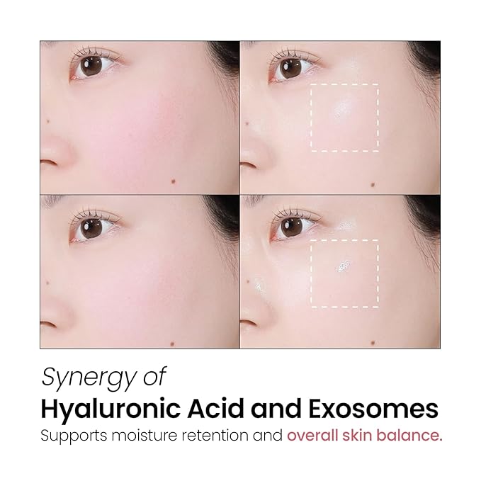 Exosome Pink Ceramide Emulsion – Korean Skincare Lightweight Moisturizer with Ceramides, Vitamin B12 & Exosome for Daily Hydration & Skin Conditioning (200ml / 6.76 fl. oz)
