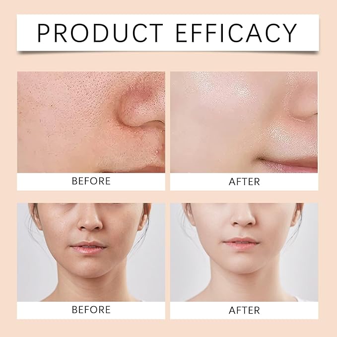 Hydrating Facial Toner - Deep Penetration, Long-Lasting Moisture, Brightens & Evens Skin Tone, Reduces Fine Lines, Refreshing Skincare(2PCS)