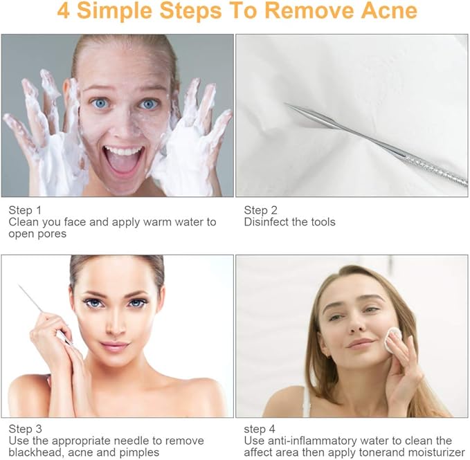 Blackhead Remover Tools, 9PCS Pimple Popper Tool Kit - Stainless Steel Pimple/Comedone Extractor & Tweezers for Acne/Zit Removal, Nose & Face Extraction Tools for Estheticians with Leather Case