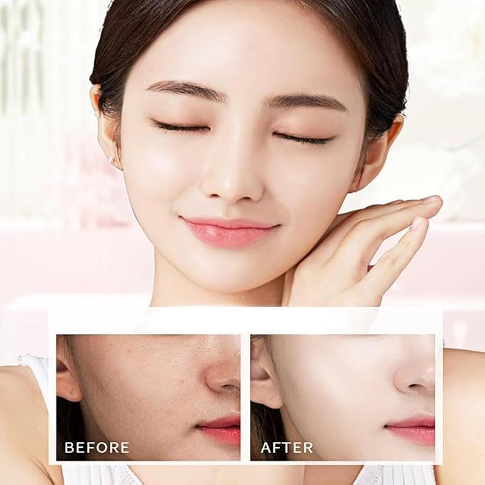 Moisturizing Tone-Up Concealer Cream, Moisturizing 𝐁𝐫𝐢𝐠𝐡𝐭𝐞𝐧ing Tone-up Concealer Cream, Five Fold VC Skincare Creams, Vitamin C Face Serum Moisturizer (2PCS)