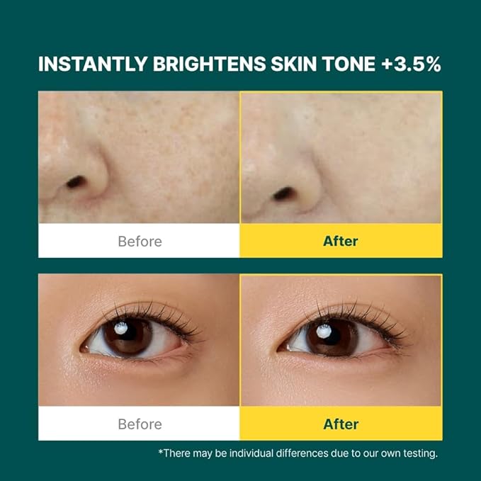 Vita C Conceal Eye Cream - Hydrating Color-Correcting Korean Eye Cream for Dark Circles with Vitamin C, Retinol | Light Medium, Dewy Finish, Medium Coverage | 0.34 fl. oz. / 10ml
