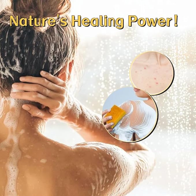 3 Pack Lemon & Turmeric Soap Bar for Dark Spots, Powered by Kojic Acid, Vitamin C - Deeply Moisturizing with Amino Acids & Shea Butter - SLS Free for Face/Body