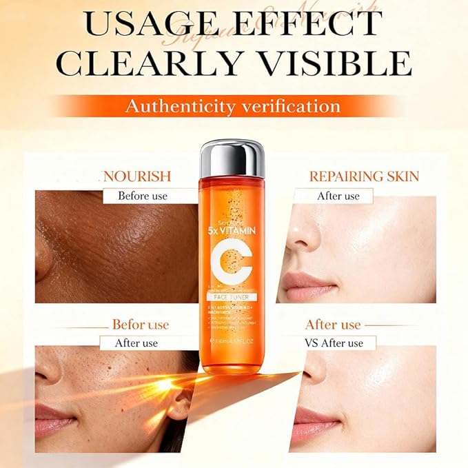 5X Vitamin C Toner, Hyaluronic Acid Facial, Suitable for Face, Arms, and Legs, Natural Ingredients, Powerfully Moisturizing, Face for Sensitive Skin (Face Vitamin C Toner for Women Anti Aging)