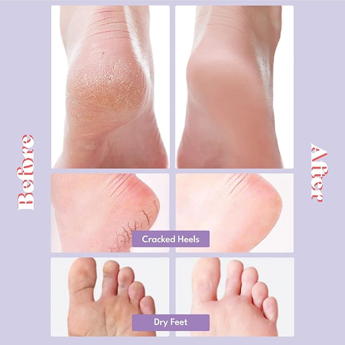 Toi:L Extra Silky Foot Mask 5 Pairs, Post-Peeling Foot Care Treatment, Moisturizing Socks with Guerande Salt & Sweet Almond Oil for Dry Feet, Cracked Heels, and Callus, Easter Basket Stuffer