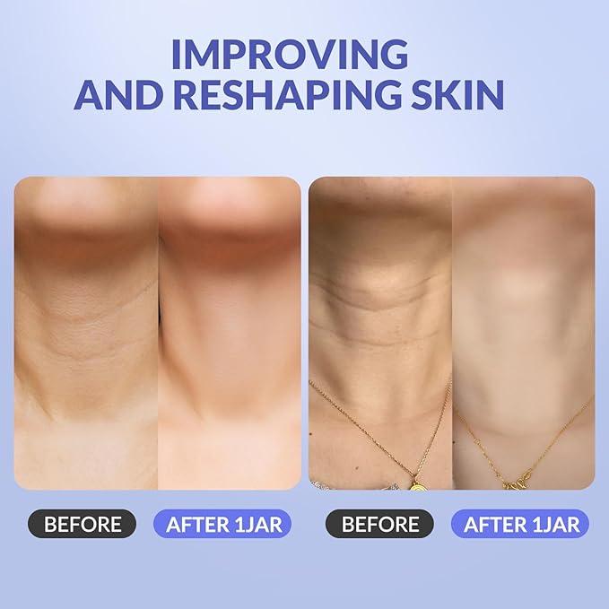 Crogooe Neck Firming Cream - Neck Creams for Tightening and Firming, Tightening and Lifting Wrinkles & Crepey Skin for Neck & Décolleté-1.7 fl.oz