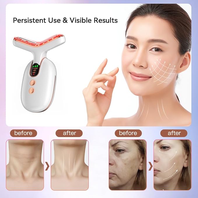 Micro-Current Facial Beauty Device, Red Light Therapy for Face, 3 Color LED Facial Massager for Skin Care with Thermal, Vibration, White