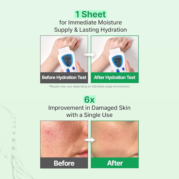 Zipiderm EGF Skin Barrier 4-Step Repair Set – Milky Toner, Hydrating Ampoule, Intensive Cream & Dressing Sheet Mask | Ceramide, Panthenol & Bio-EGF Korean Skincare Routine for Damaged, Dry & Sensitive