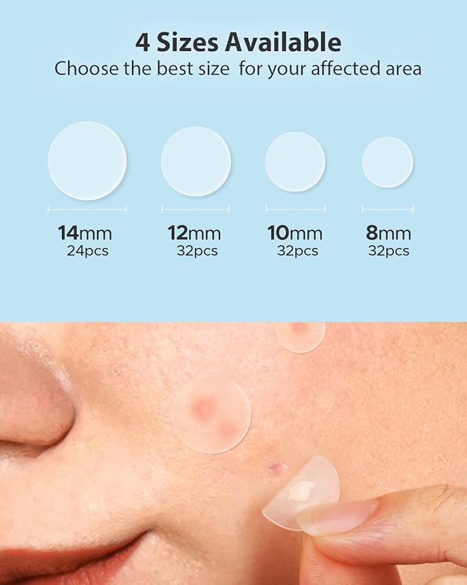 LitBear Acne Pimple Patches- Day and Night 4 Sizes 180 Dots Thin & Thick Hydrocolloid Patches with Witch Hazel, Tea Tree & Calendula Oil, Pimple Stickers for Covering Zits, Blemishes, Spots, Acne Dots