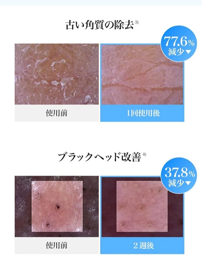 Dear Klairs EGF Blue Calming Toner Pad with Guaiazulene & CICA Exosome, Uneven Tone, Deep Hydration, Korean Exfoliating Face Skin Care, K-Beauty, 5.07 Fl Oz, 60 Pads