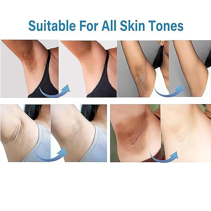 Skin Lightening Cream for Intimate Area with Niacinamide, Arbutin, Tranexamic Acid and Vitamin C, Even Skin Tone for Body, Underarm, Knees, Elbows, Inner Thigh, Bikini Areas Bleaching Whitening Cream