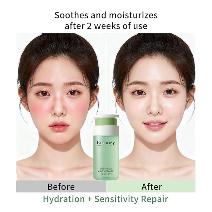 Moisturizing Aloe Vera Gel,Soothing Hydrating Face Body Gel with Pure Aloe Extract, Korean Skincare Green Tea Calms Redness, Repairs After Sun,Refreshes Sensitive Skin (8.8oz