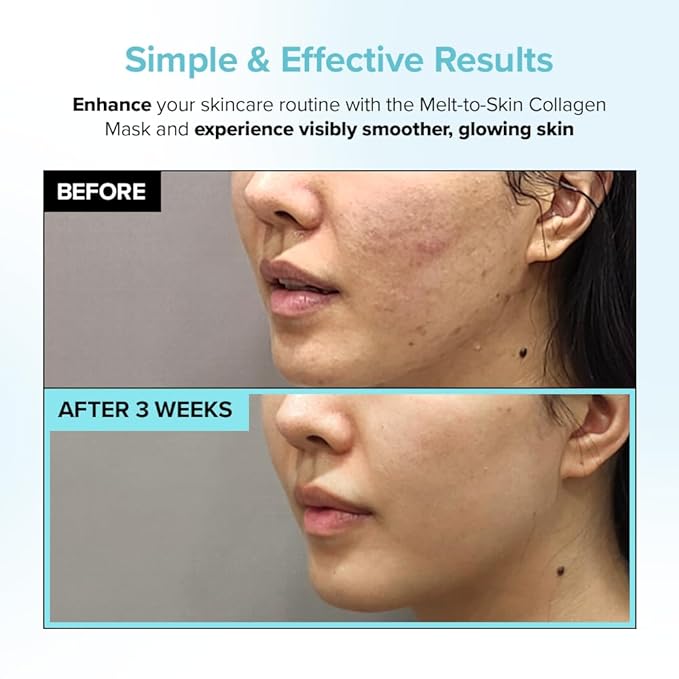 Melt to Skin Collagen Mask, – Wrinkle Patches for Forehead, Eyes & Smile Lines - Frown Lines, Eleven-Lines Repair Patches, Invisible Face Wrinkles Smoothers - Korean Skin Care, 12EA (12)