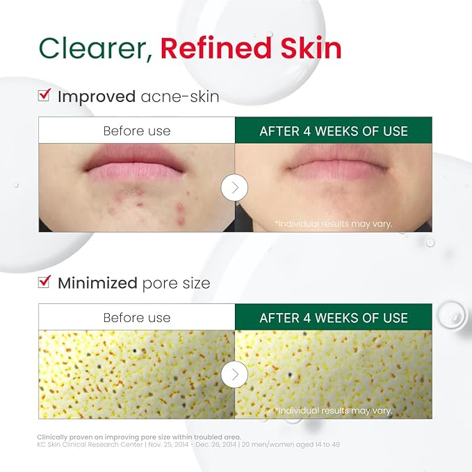 Dr. G R.E.D. Blemish Clear Hyal-Cica Soothing Serum - Korean Skincare - Long-Lasting, Hydrating Serum for All Skin Types - Cools Skin Temperature - Hyaluronic Acid & Centella Asiatica - 1.69 fl oz