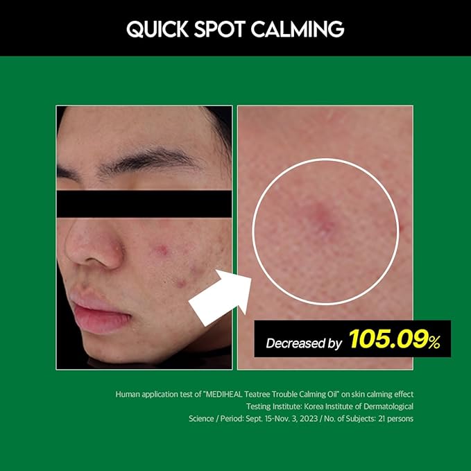 Mediheal Teatree Trouble Calming Oil (0.33 fl oz), Quick Calming and Deep Hydration with Control Excess Oil for Sensitive Skin Type