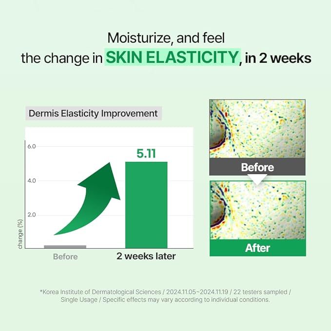 Zipiderm EGF Skin Barrier Deep Moisture Set – Cream Toner + Intensive Cream Moisturizer, Korean Hydrating & Barrier-Repair Duo for Sensitive, Dry & Irritated Skin