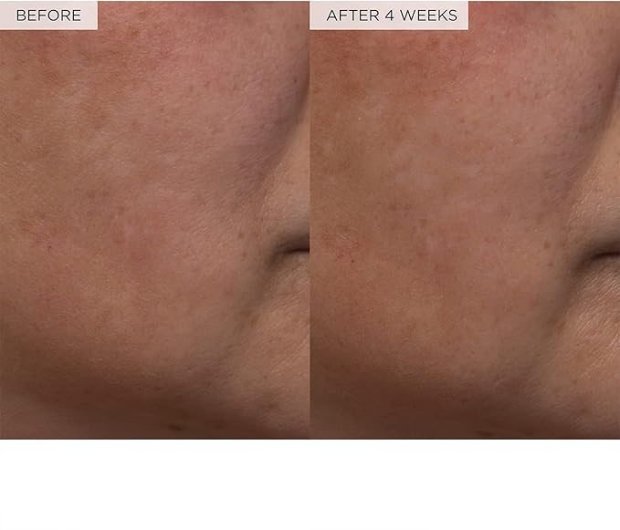 Glow Recipe Toner Duo - Glow Recipe PHA+BHA Pore Minimizer & Facial Exfoliator for Glass Skin - Tightening & Hydrating Skincare with Hyaluronic Acid (150 ml & 40 ml)