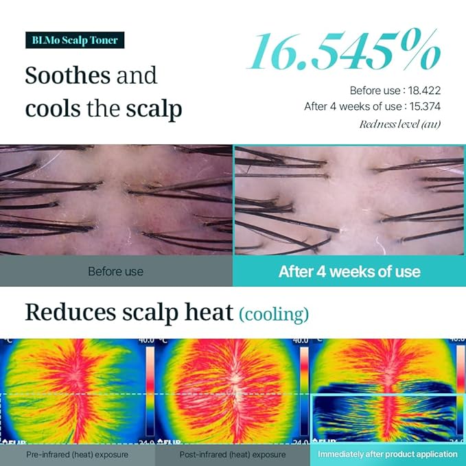 Scalp Serum for Hair Loss & Thinning with Massaging Tips | Clinically Proven | Thickens & Accelerates Hair Growth | Supports DHT Balance | Korean Hair Care | Low Irritation, Drug-Free | 4.05 fl.oz