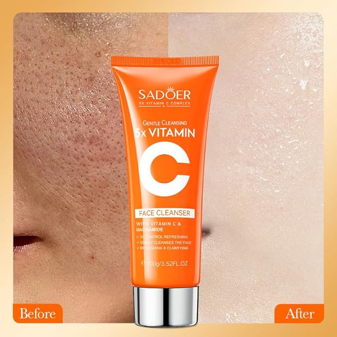 5X Vitamin C Face Cleanser 100g Niacinamide & Hyaluronic Acid, Gentle Pore Refining Daily Wash for Oily &Dull Skin,Clear,Oil Balancing, Popular Skincare Gift Women (2 Face Cleanser + 1 Toner)
