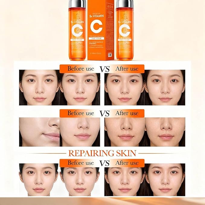 5X Vitamin C Toner, Hyaluronic Acid Facial, Suitable for Face, Arms, and Legs, Natural Ingredients, Powerfully Moisturizing, Face for Sensitive Skin (Face Vitamin C Toner for Women Anti Aging)